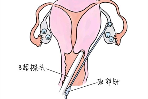 http://shenyang.huochezhan.net/post/205.html|沈阳供卵助孕