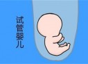 培养沈阳捐卵宝宝艺术细胞的小技巧