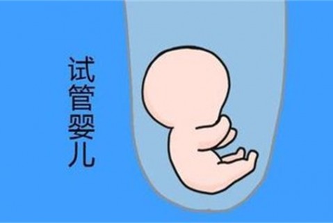 培养沈阳捐卵宝宝艺术细胞的小技巧